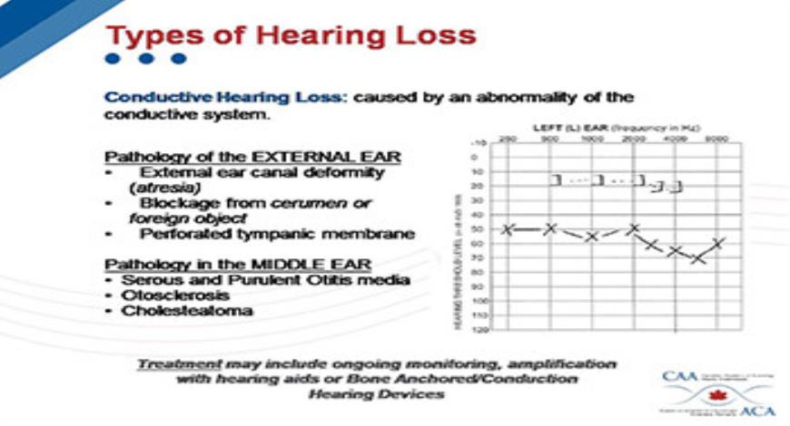 Download Free Medical The Impact of Hearing Loss PowerPoint Presentation