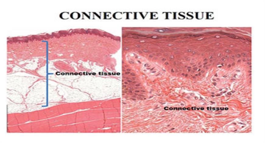 Download Free Medical Connective Tissue PowerPoint Presentation