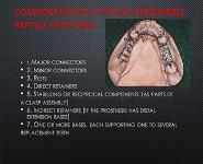 Maxillary major connectors PowerPoint Presentation