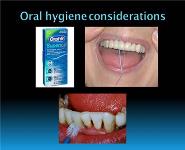 pontics PowerPoint Presentation Notes