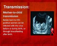 AIDS PowerPoint Presentation