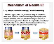 Laser PowerPoint Presentation