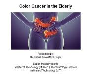 Colon Cancer in the Elderly PowerPoint Presentation