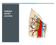 How to apply a traction splint PowerPoint Presentation