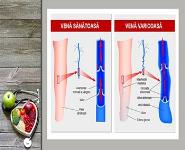 PROBLEME CU INIMA PowerPoint Presentation