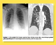 Cardiothoracic Imaging PowerPoint Presentation