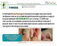 Fimose PowerPoint Presentation
