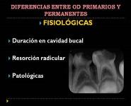Pulp treatment in primary dentition PowerPoint Presentation