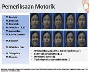 Facial Nerve Palsi PowerPoint Presentation Notes