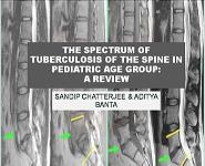 Pediatric Spinal Tuberculosis PowerPoint Presentation
