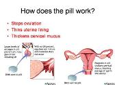 Birth Control - Contraception