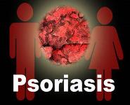 PSORIASIS PowerPoint Presentation