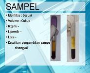 B-HCG Terlalu Tinggi PowerPoint Presentation Notes