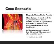 Critical Appraisal Chronic Plantar Fasciitis PowerPoint Presentation