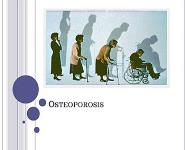 Osteoporosis PowerPoint Presentation