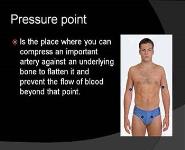 Wounds and Bleeding PowerPoint Presentation
