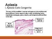 Aplasia - Abnormalities in Cell Growth