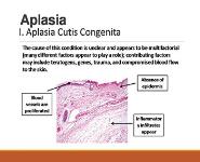 Aplasia - Abnormalities in Cell Growth PowerPoint Presentation