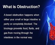 Obstruction of Small Intestine PowerPoint Presentation Notes