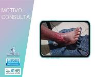 Teleconsulta y Heridas PowerPoint Presentation Notes