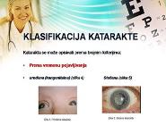 Katarakta i njega bolesnika sa kataraktom PowerPoint Presentation