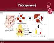 Neonatal Hemolytic Disease PowerPoint Presentation