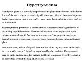 Hyperthyroidism