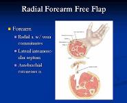 Free Flap Reconstruction in Head and Neck PowerPoint Presentation