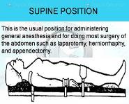 Surgical Positions PowerPoint Presentation