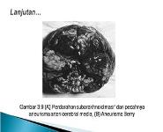 Kematian Akibat Penyakit Ilmiah PowerPoint Presentation Notes