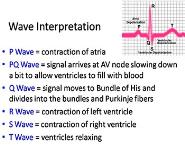 ECG PowerPoint Presentation