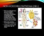 NON-HODGKIN LYMPHOMA (NHL) PowerPoint Presentation