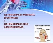 Hemorragie Meningee PowerPoint Presentation