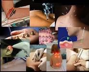 Acupuncture for the Pediatric Patient - Ancient Approaches for Modern Ailments PowerPoint Presentation