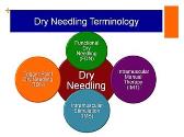 Dry Needling