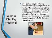 Dry Needling by Physical Therapists