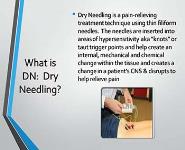Dry Needling by Physical Therapists PowerPoint Presentation