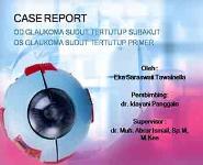Glaucoma PowerPoint Presentation