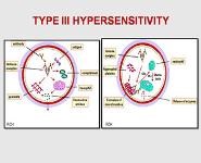 Oral Manifestations of Allergic Diseases PowerPoint Presentation