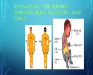 Burn Management PowerPoint Presentation