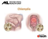 What does STI stand for PowerPoint Presentation