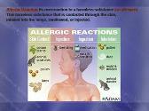 Allergy An Overview