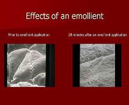 The Treatment And Management of Eczema PowerPoint Presentation Notes