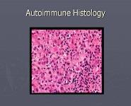 Autoimmune Hepatitis PowerPoint Presentation Notes