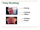 An approach to a child with respiratory symptoms