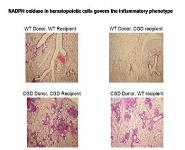 NADPH oxidase regulator of host defense and inflammation PowerPoint Presentation Notes