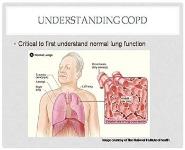 COPD - Chronic Obstructive Pulmonary Disease PowerPoint Presentation