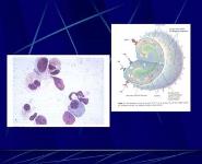 Ocular allergy PowerPoint Presentation