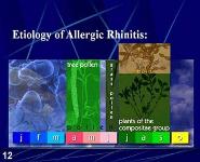 Rhinitis PowerPoint Presentation Notes