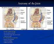 Rheumatoid Arthritis PowerPoint Presentation Notes